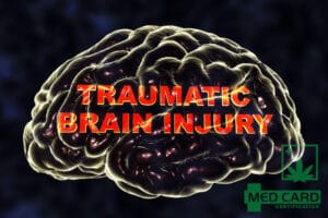 Marijuana Help With and Treat Traumatic Brain Injury
