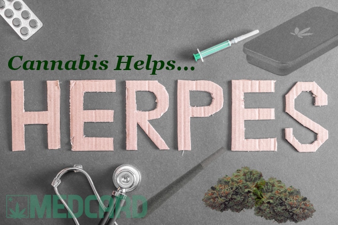 Cannabis Helps Herpes
